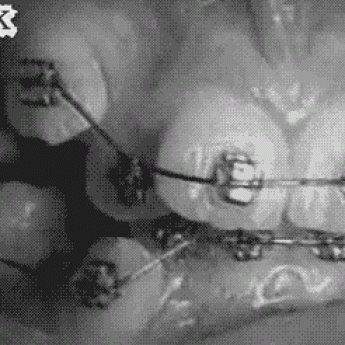 GIF: Zubný strojček